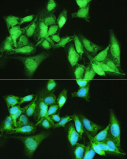 Anti-KDM7A Antibody (CAB14692)