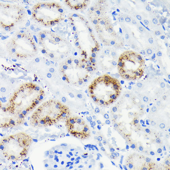 Anti-Fas Antibody [KO Validated] (CAB19582)