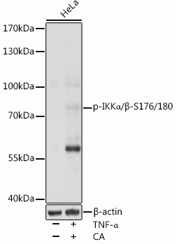 Anti-Phospho-IKK alpha/beta-S176/180 pAb (CABP0891)