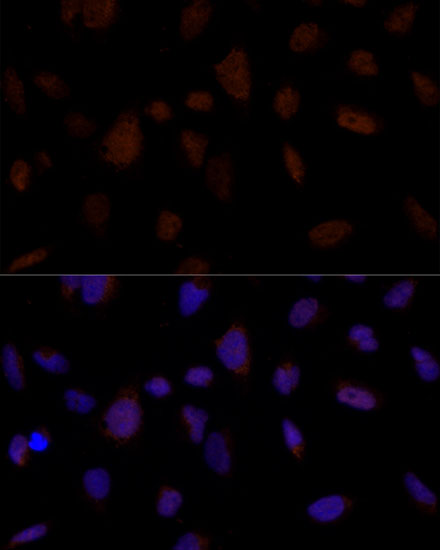 Anti-BRE Antibody (CAB15122)