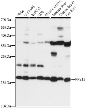 Anti-RPS13 Antibody (CAB15720)