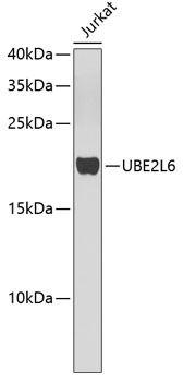 Anti-UBE2L6 Antibody (CAB4282)