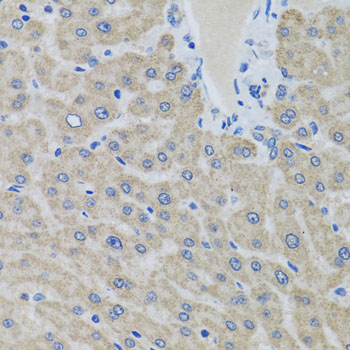 Anti-EIF2S3 Antibody (CAB6581)