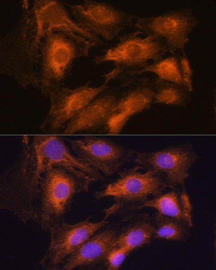 Anti-ARCN1 Antibody (CAB14993)