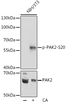 Anti-Phospho-PAK2-S20 pAb (CABP0803)