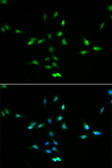 Anti-MDM2 Antibody (CAB0345)