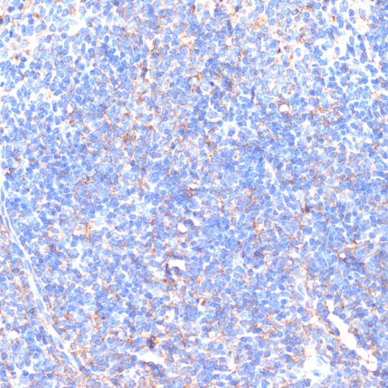 Anti-MMP9 Antibody (CAB11147)