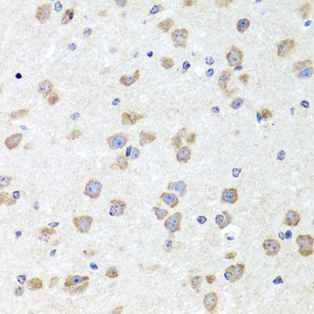 Anti-CHD1 Antibody [KO Validated] (CAB7883)