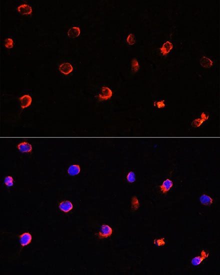 Anti-AIPL1 Antibody (CAB6458)