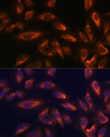 Anti-SSTR2 Antibody (CAB3135)