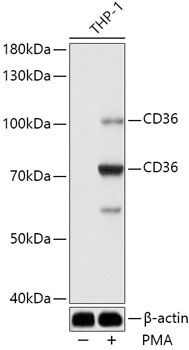 Anti-CD36 Antibody (CAB14714)