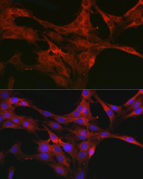 Anti-CDC42 Antibody (CAB1188)