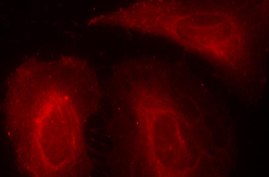 Anti-Phospho-PDPK1-S241 Antibody (CABP0426)