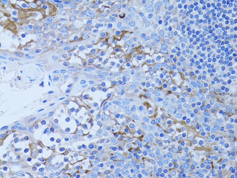 Anti-HADH Antibody (CAB1076)