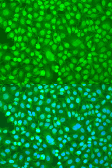 Anti-PER1 Polyclonal Antibody (CAB8449)