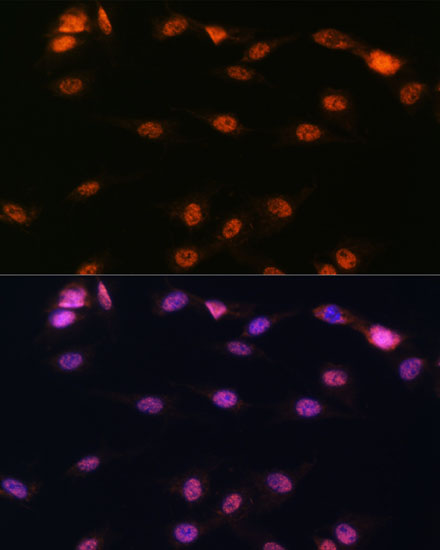 Anti-ALOX5 Antibody (CAB2158)