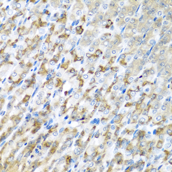 Anti-CST1 Antibody (CAB6570)