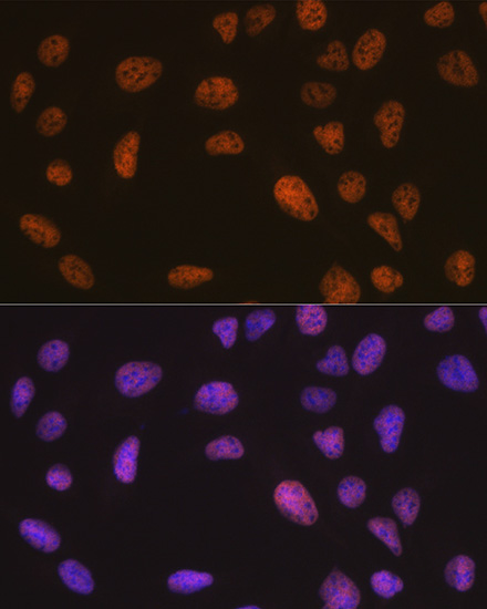 Anti-SNF5 Antibody [KO Validated] (CAB3247)