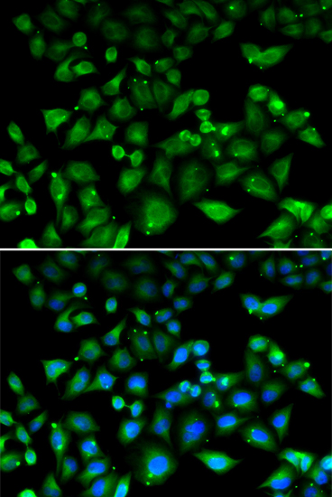 Anti-NHLRC1 Antibody (CAB6669)