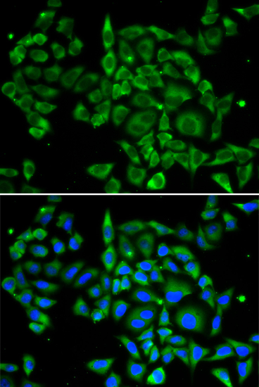 Anti-PRKCA Antibody (CAB0267)