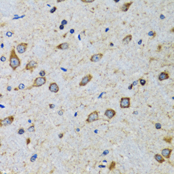 Anti-CDK1 Antibody (CAB0220)