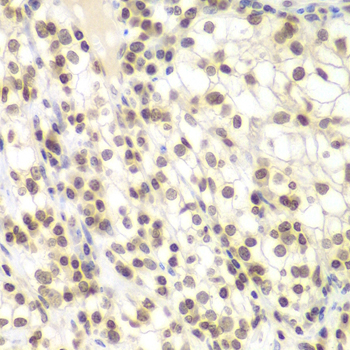 Anti-UHRF2 Antibody (CAB13602)