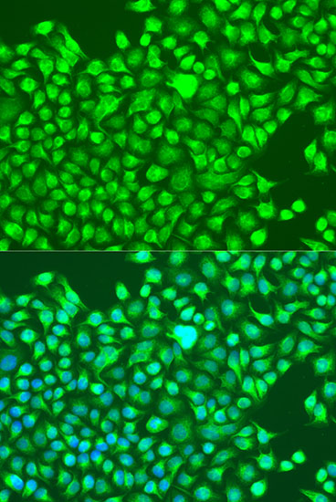 Anti-GRIN1 Antibody (CAB13995)