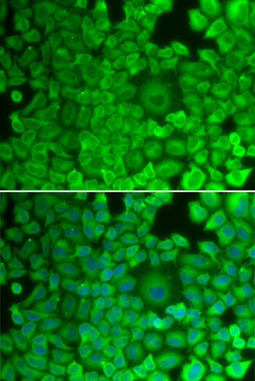 Anti-GYS1 Antibody (CAB2519)