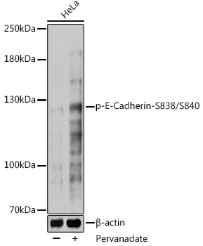 Anti-Phospho-E-Cadherin-S838/S840 Antibody (CABP1074)