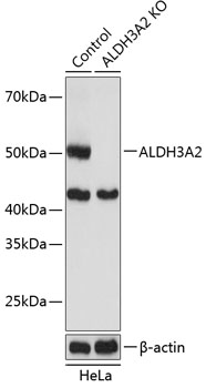 Anti-ALDH3A2 Antibody [KO Validated] (CAB19899)