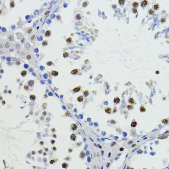 Anti-ZEB1 Antibody (CAB5600)