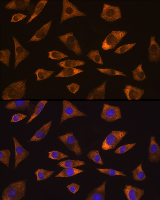 Anti-CAPRIN1 Antibody (CAB7910)