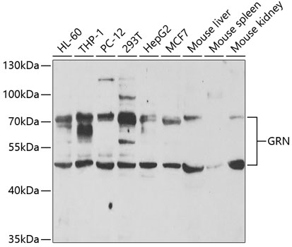 Anti-GRN Antibody (CAB5773)