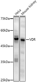 Western blot analysis of extracts of various cell lines, using VDR antibody at 1:1000 dilution. Secondary antibody: HRP Goat Anti-Rabbit IgG (H+L) at 1:10000 dilution. Lysates/proteins: 25ug per lane. Blocking buffer: 3% nonfat dry milk in TBST. Detection: ECL Enhanced Kit. Exposure time: 90s.