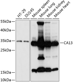 Anti-CA13 Antibody (CAB14467)