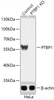 Anti-PTBP1 Antibody [KO Validated] (CAB18084)