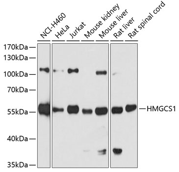 Anti-HMGCS1 Antibody (CAB3916)