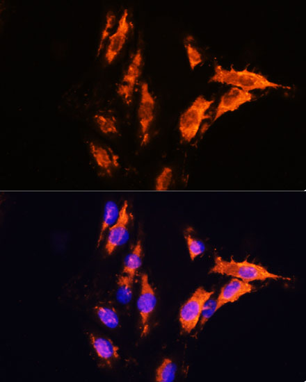 Anti-MFGE8 Antibody (CAB12322)