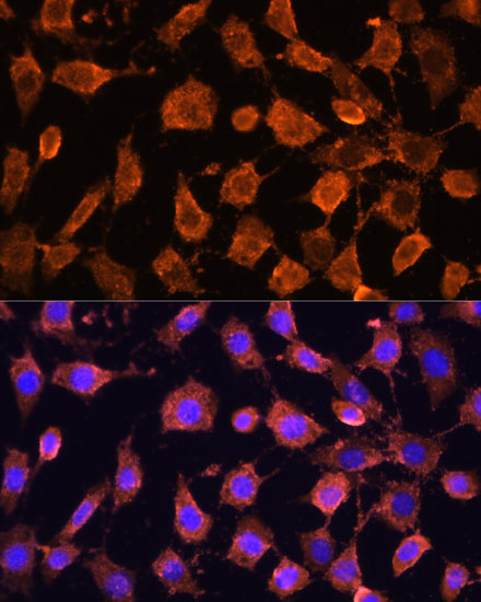 Anti-RPL11 Antibody (CAB6407)