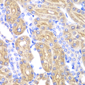 Anti-ALDH2 Antibody (CAB1226)