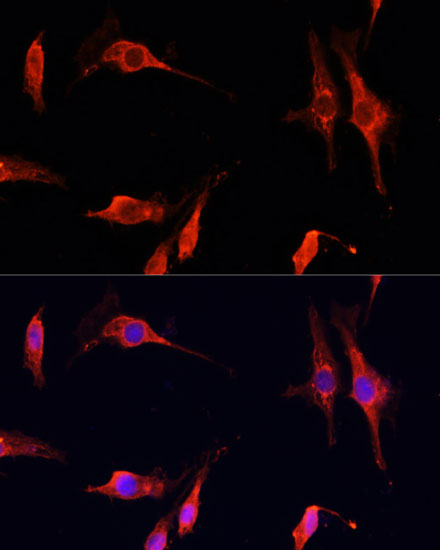 Anti-DNASE1 Antibody (CAB14531)