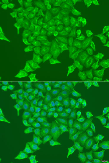 Anti-BST2 Antibody (CAB1914)