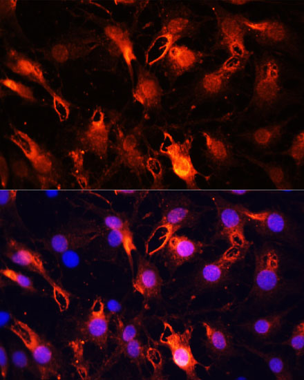 Anti-RNF149 Antibody (CAB15627)