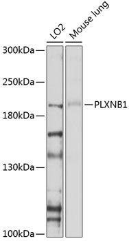 Anti-PLXNB1 Antibody (CAB10010)