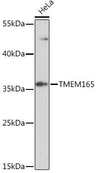 Anti-TMEM165 Antibody (CAB17183)