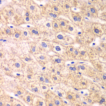 Anti-TXN2 Antibody (CAB12591)