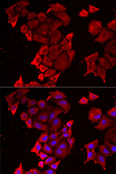 Anti-TIMM17A Antibody (CAB6449)