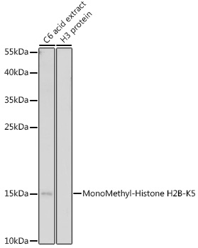 Anti-MonoMethyl-Histone H2B-K5 Antibody (CAB17552)