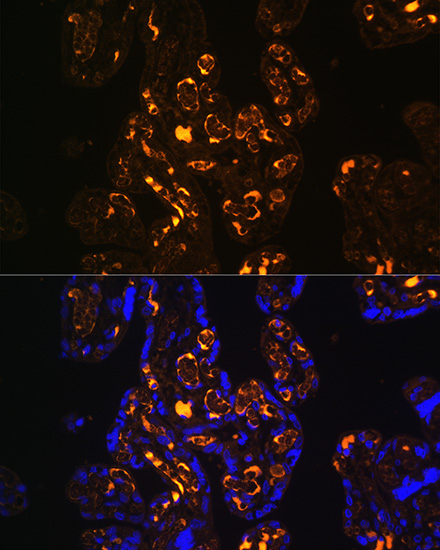 Anti-LRP8 Antibody (CAB10517)