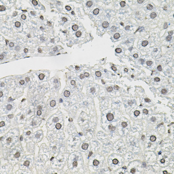 Anti-TCEB1 Antibody (CAB1989)